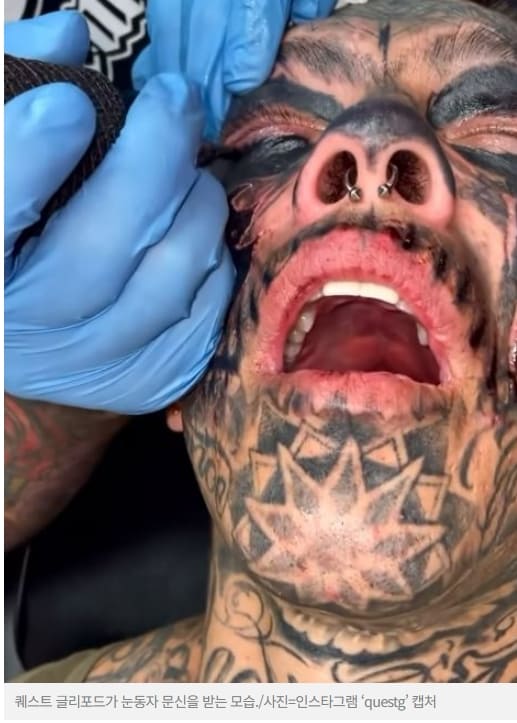 눈동자에 문신한 미국 남성...영구히 안 지워져 VIDEO: TikToker Quest Gulliford Gets His Eyeballs Tattooed Black in $10&#44;000 Procedure