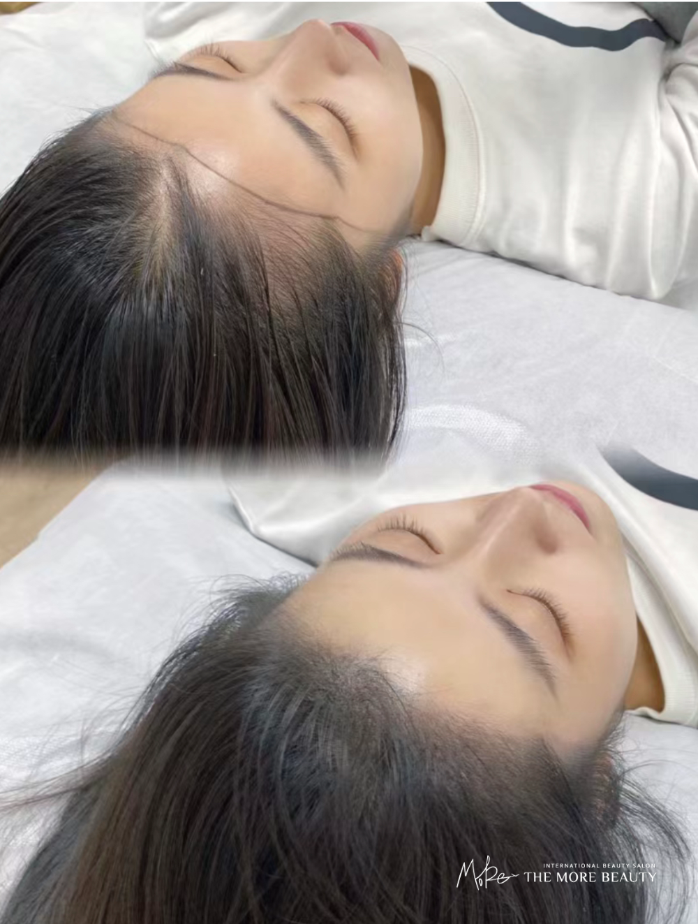이미지헤어라인 이미지
