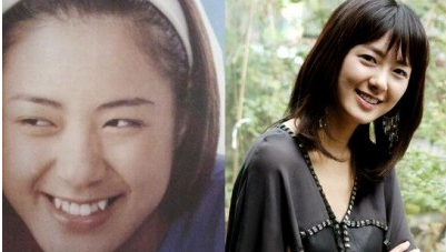  이요원 성형전 사진과 류승수 과거 인연