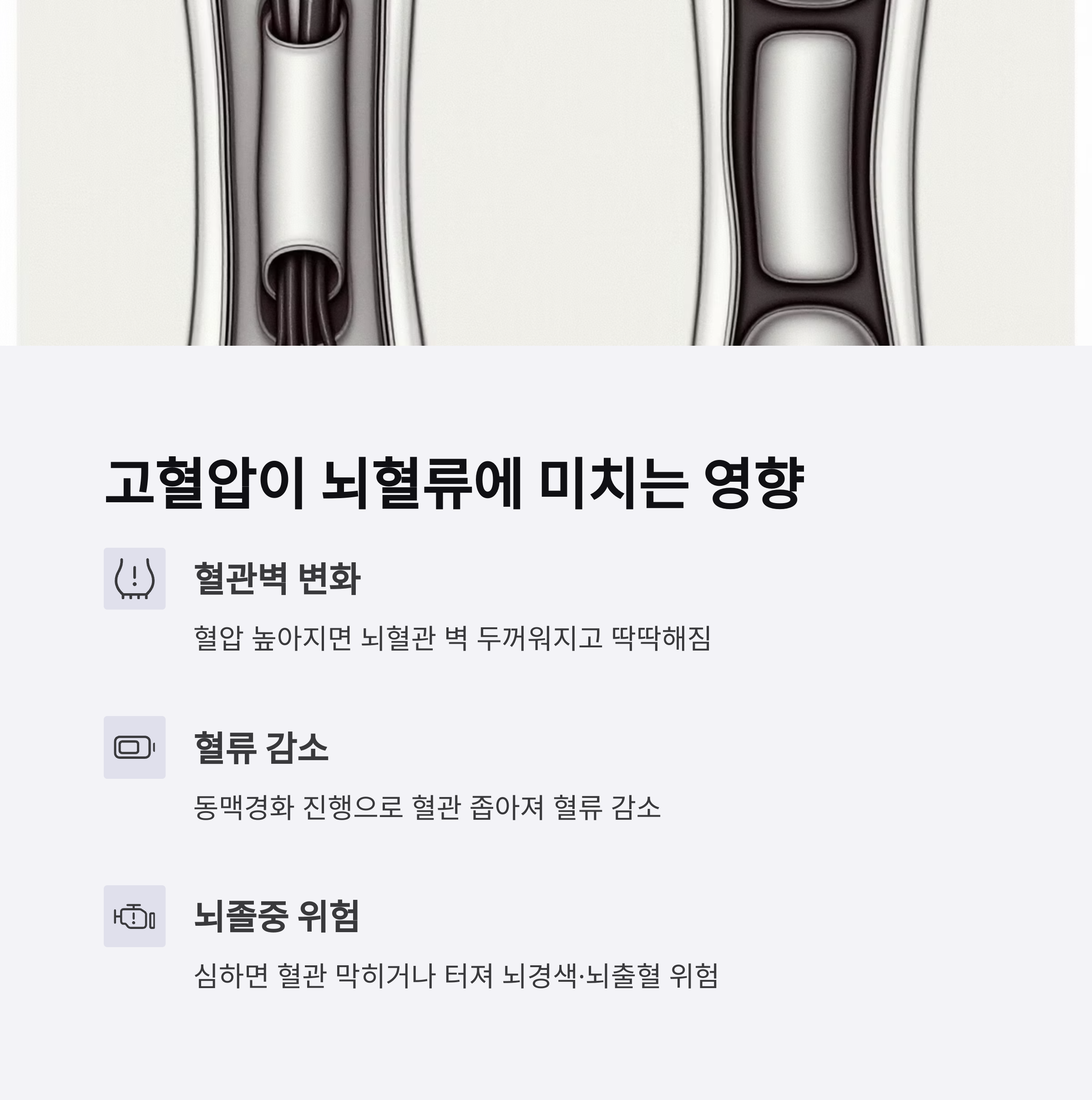 고혈압과 당뇨가 뇌혈류 장애를 일으키는 이유
