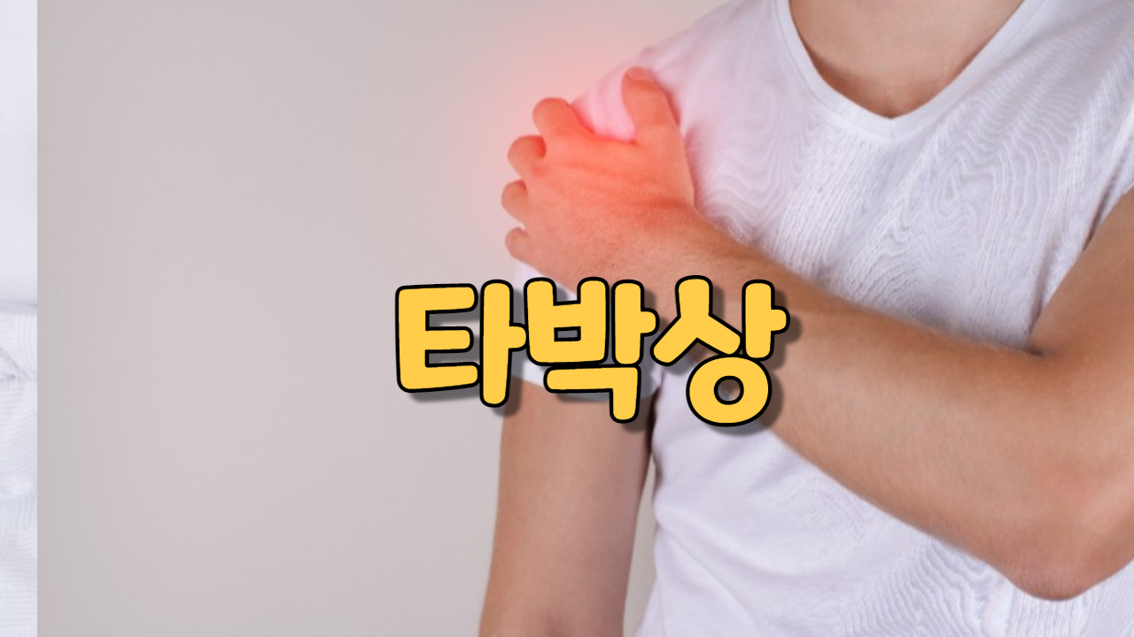  타박상