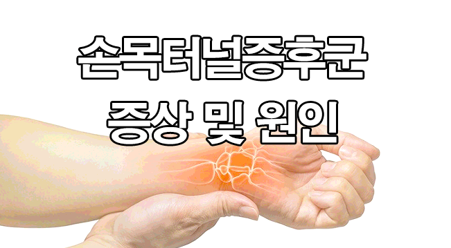  손목터널증후군 증상 및 원인 : 손저림, 수근관 증후군