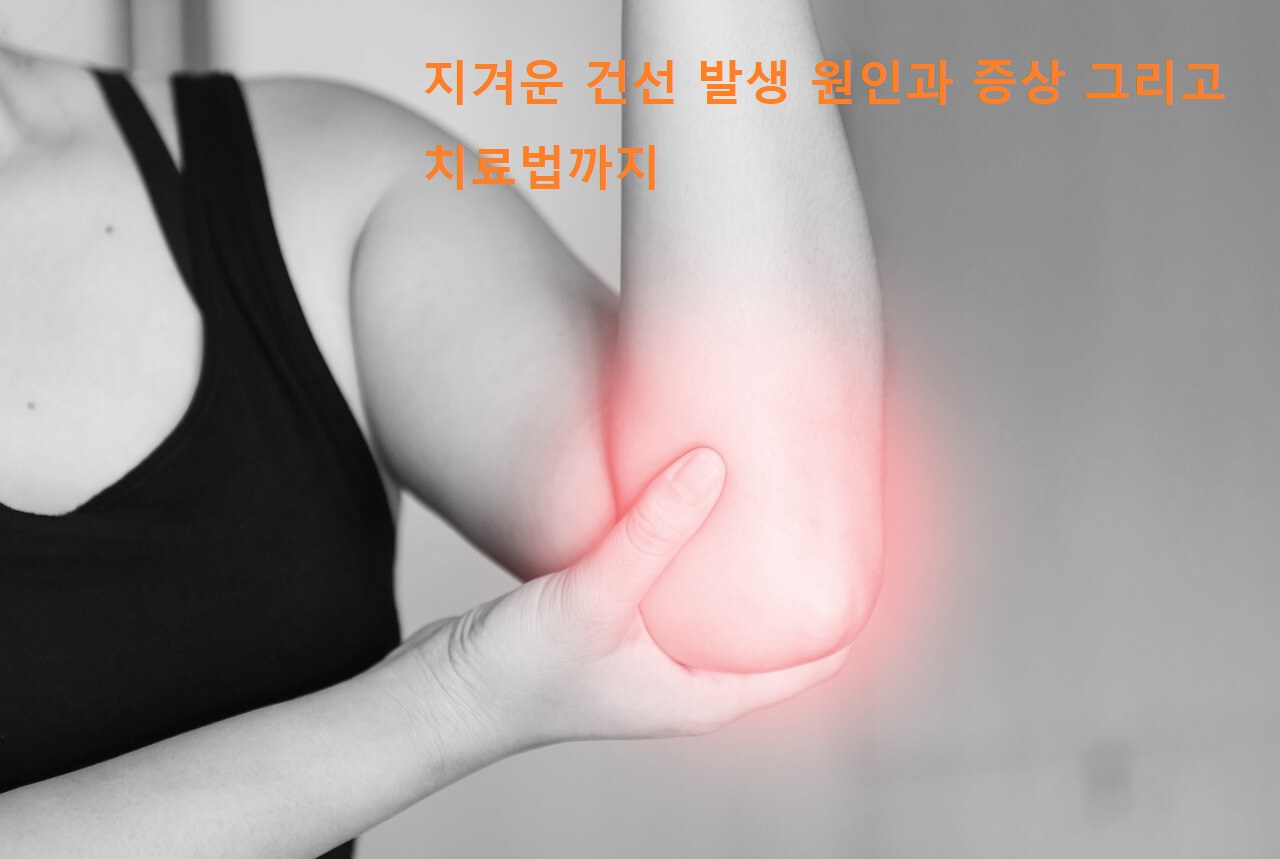  지겨운 건선 발생 원인과 증상 그리고 치료법까지
