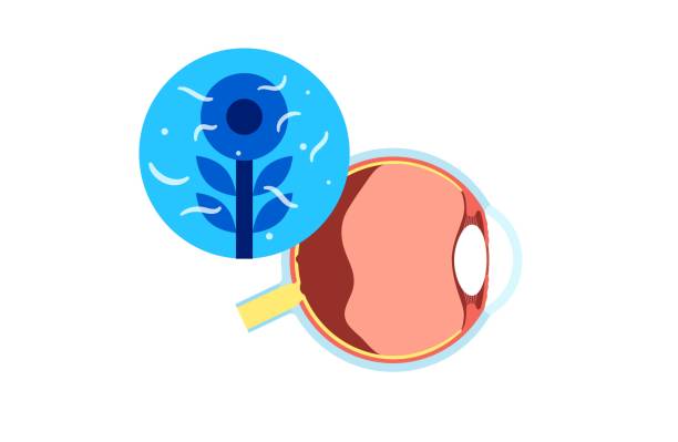 비문증 유리체 부유물 원인