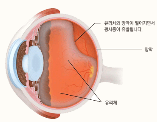 눈-구조