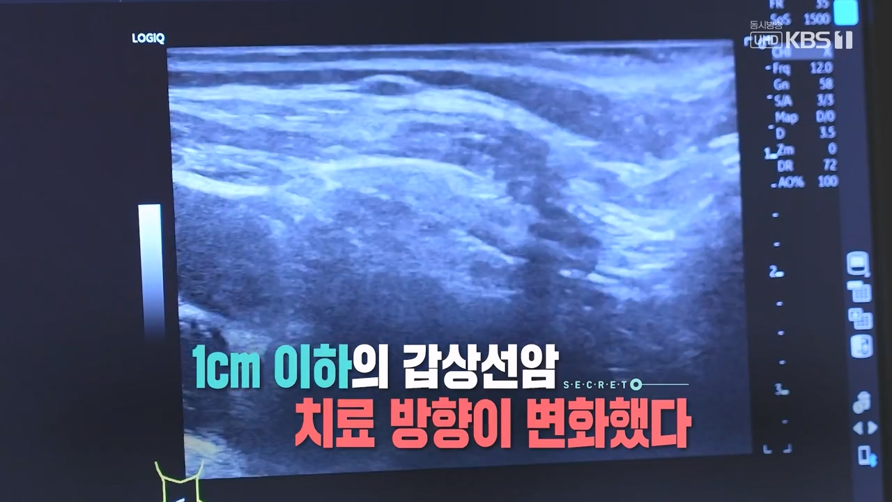 생로병사의 비밀.E894.231228p-NEXT.mp4_20231228_193015.592.jpg