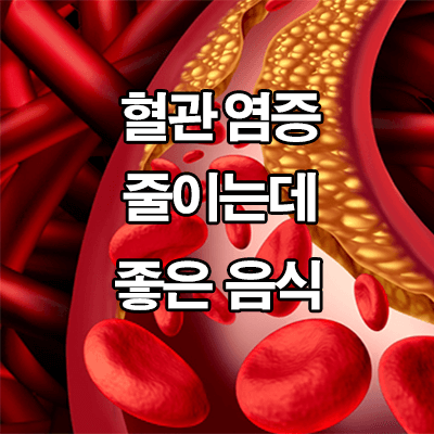  혈관 염증 줄이는데 좋은 음식 : 식품