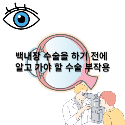  꼭 알고 수술 결정하세요. 백내장 수술을 하기 전에 알고 가야 할 수술 부작용