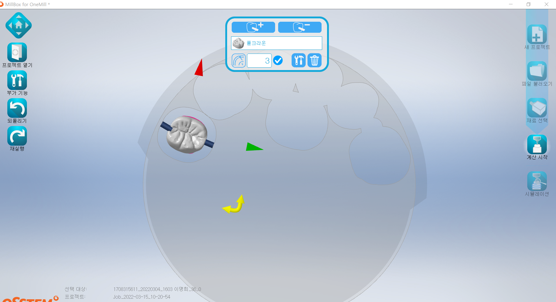 mill box 치아 위치 선택