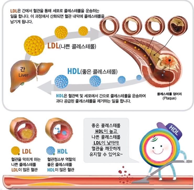 HDL콜레스테롤과 LDL콜레스테롤