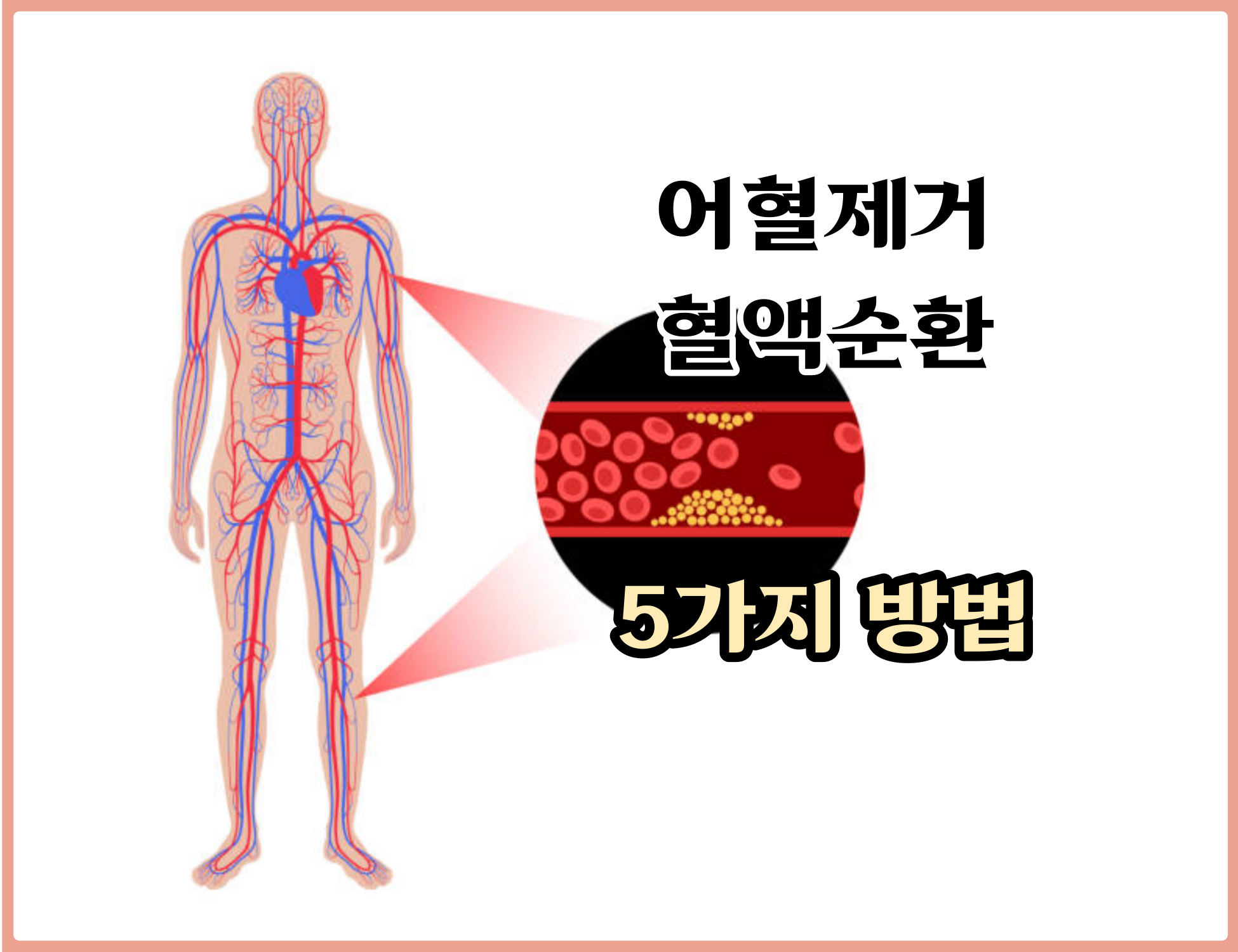  어혈을 제거, 혈액순환을 위한 방법 5가지 무엇일까요?