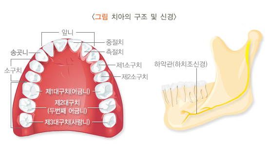  사랑니 치료법