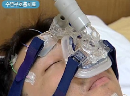  수면무호흡증 치료/검사/증상/원인