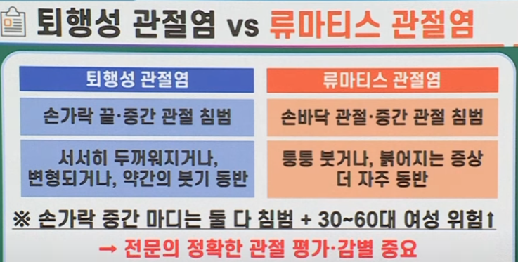 퇴행성 관절염과 류마티스 관절염 증상비교