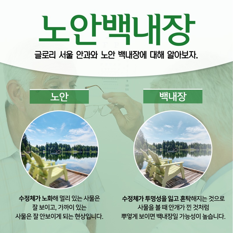 선택 백내장 수술 잘하는 병원 현명하게