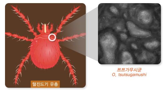 가을철 3대 전염병