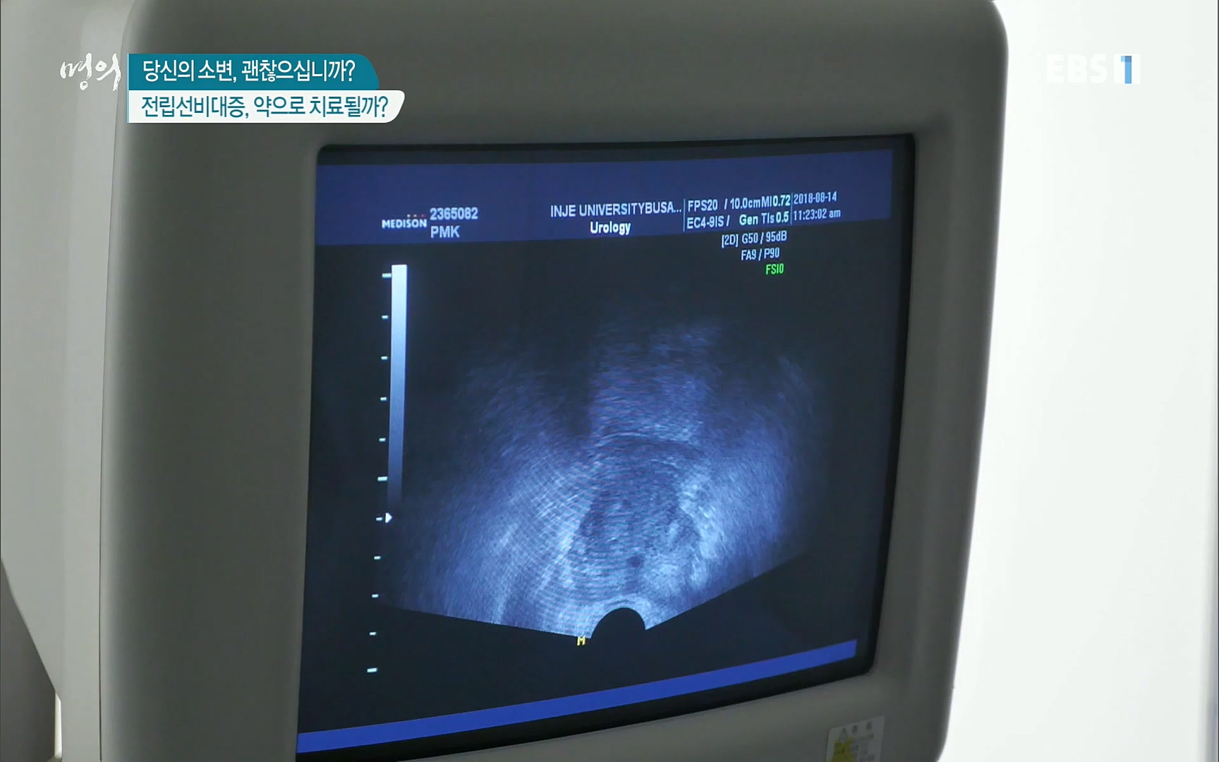 EBS 명의 헬스케어 - TV - 교육의 중심 EBS당신의 소변, 괜찮으십니까-.mp4_20220909_201556.715.jpg
