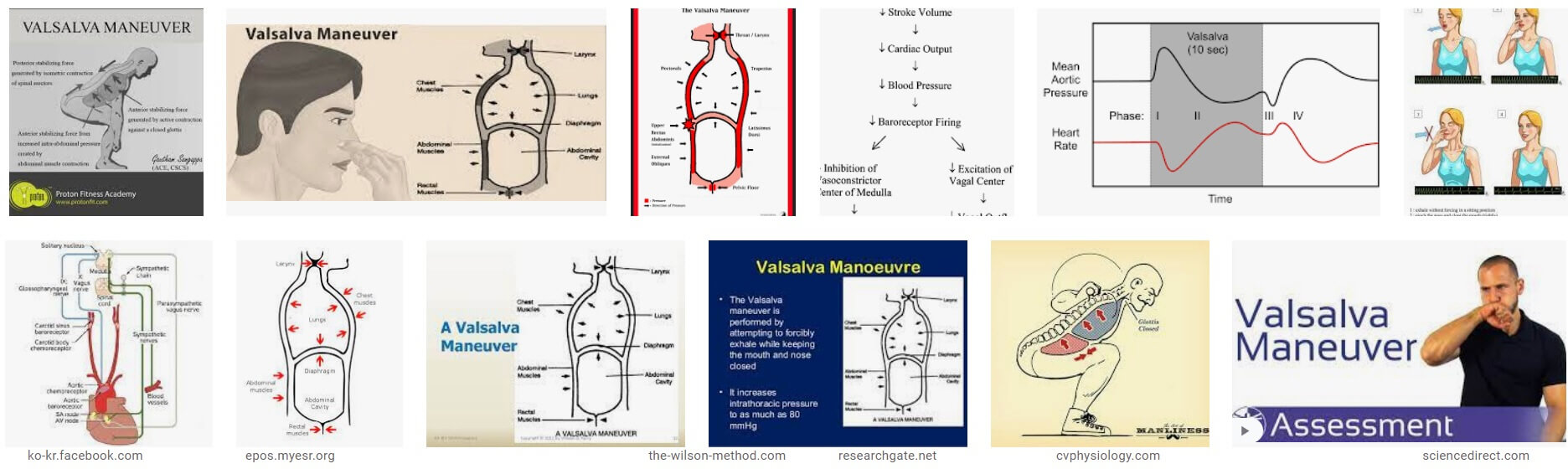 의학용어 Valsalva maneuver 뜻 발살바법