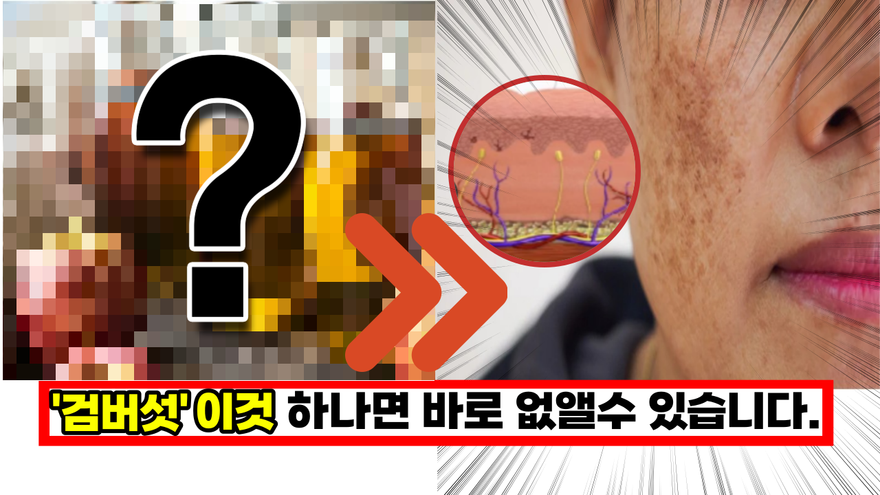  집에서 손쉽게 '검버섯' 없애는 방법, '이것' 하나면 바로 해결됩니다.