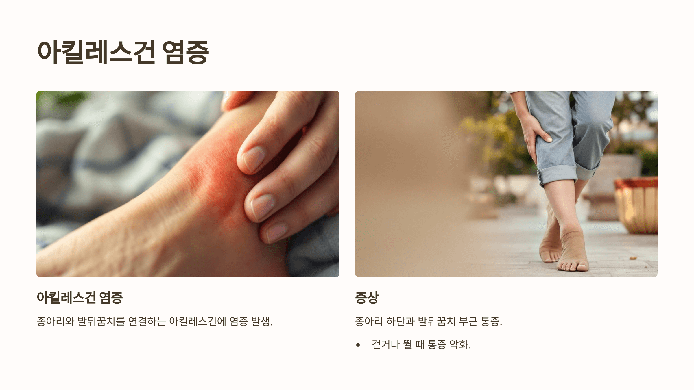 종아리 근육과 관련된 사진입니다.