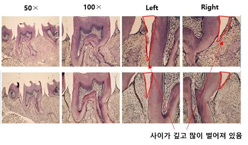 치주질환 동물 모델에서 치주질환 개선 효과 평가 (HE염색)