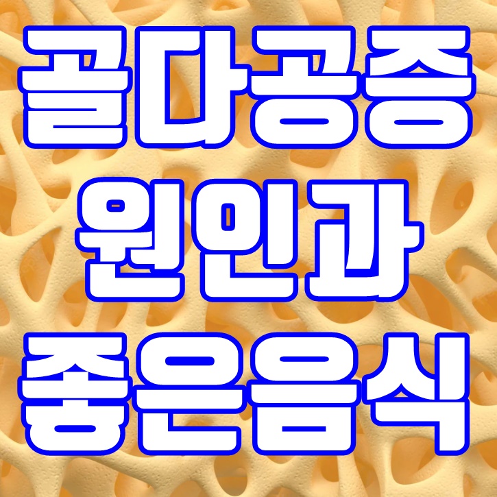  골다공증에 좋은 음식과 예방 방법
