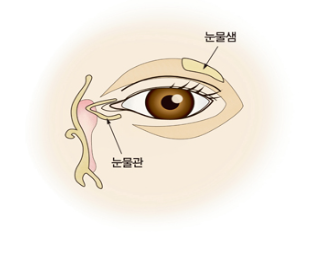  안구건조증 증상/원인/치료