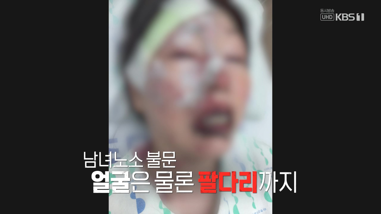 생로병사의 비밀.E910.240509p-NEXT.mp4_20240509_195921.459.jpg