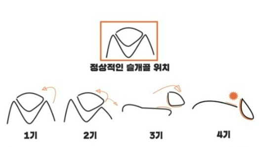  강아지 슬개골 탈구(펫보험 후기, 증상,관리,환급)