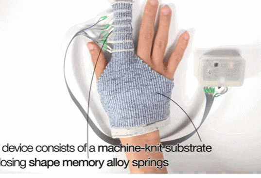 손부종 환자를 위한 로봇 섬유 VIDEO: Knitted robotic textile promising for hand edema patients