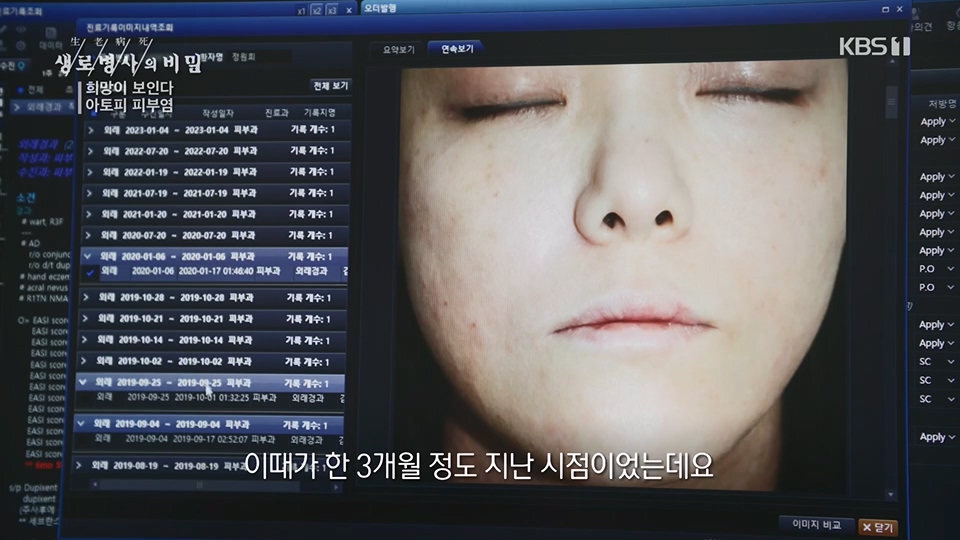 생로병사의 비밀.E872.230628p.H264-F1RST.mp4_20230707_214230.992.jpg