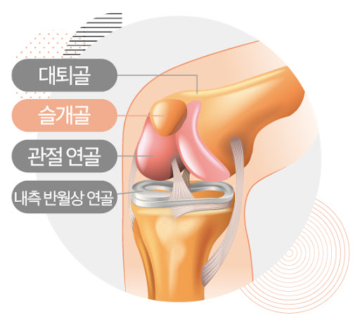 슬개대퇴관절증