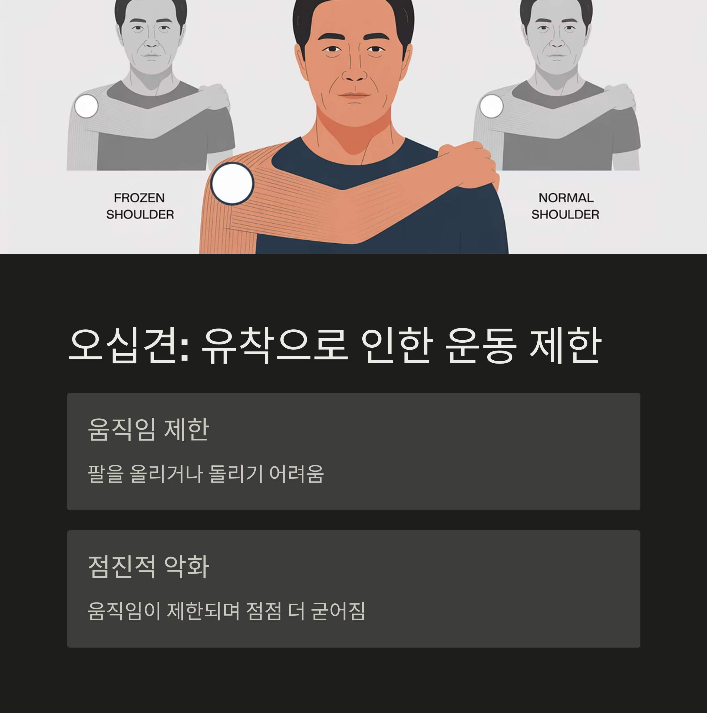 오십견으로 인한 팔 움직임 제한과 점진적 악화를 설명한 남성의 양 어깨 움직임 비교 일러스트