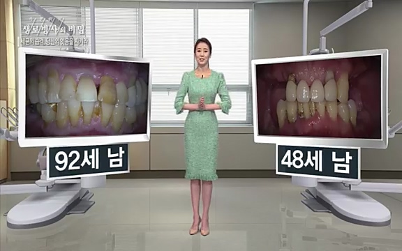 [792회] 생로병사의 비밀 - KBS[세균의 습격, 당신의 잇몸을 지켜라!] 감기보다 병원을 더 자주 찾게 만드는 질병이 있다. 바로 치주질환이다. 2020년 외래 다빈도 질병 1위를 차지한 치은염 및 치주질환 환자는 1,637_20220505_141031.138.jpg