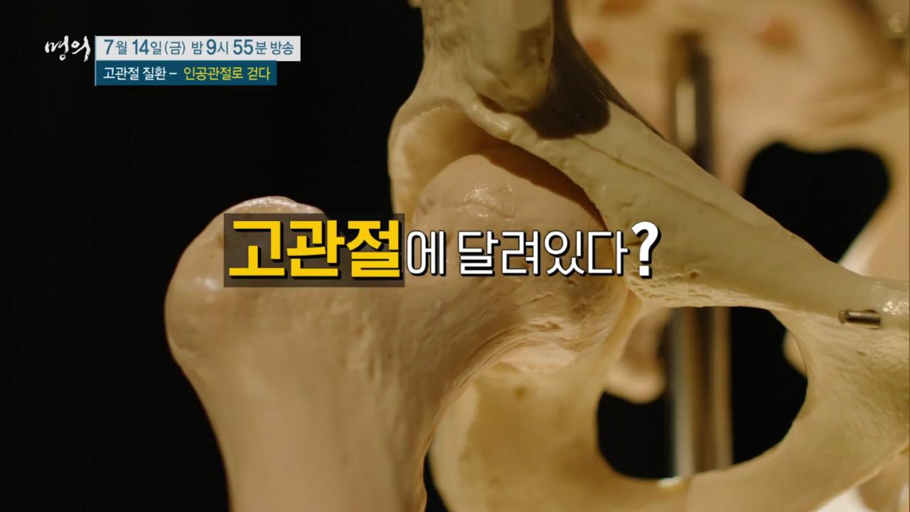 EBS 826회 명의 고관절 질환 - 인공관절로 걷다, 수술 후 합병증, 부작용 및 생활 관리, 퇴행성 관절염, 골절, 대퇴골두무혈성 괴사 치료 방법 강북 삼성병원 박윤수 박재형 교수