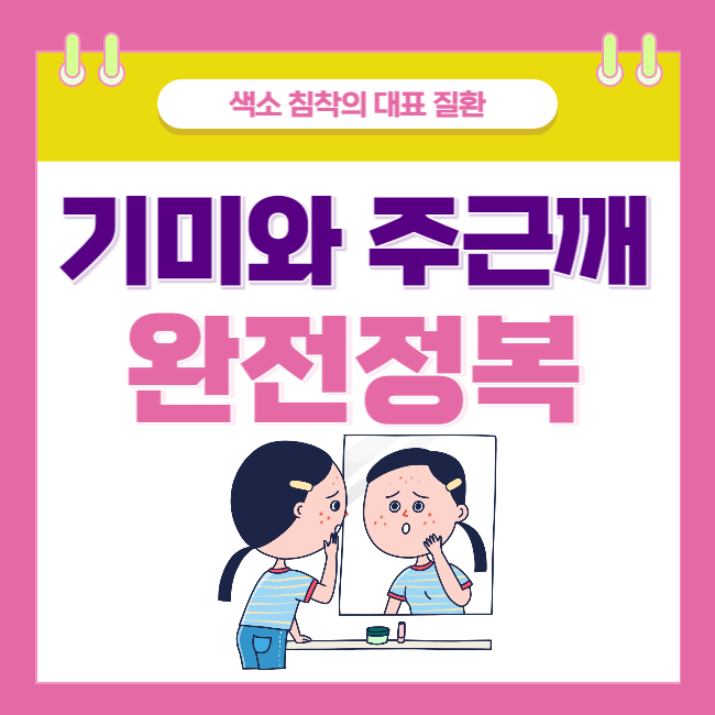  색소 침착의 대표 질환, 기미와 주근깨(공통점과 차이점, 예방법)