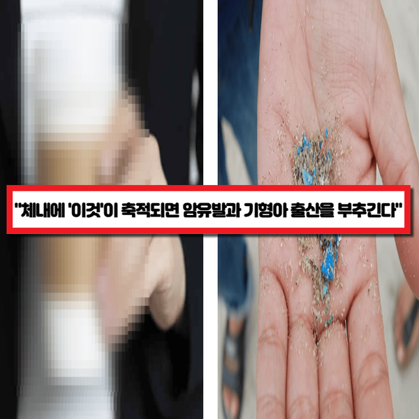  "절대 쓰지 마세요!" 전 세계 사람들이 쓰는 건데 알고 보니 위암을 유발하고 뇌세포를 파괴하는 '이것'이 검출되었다!
