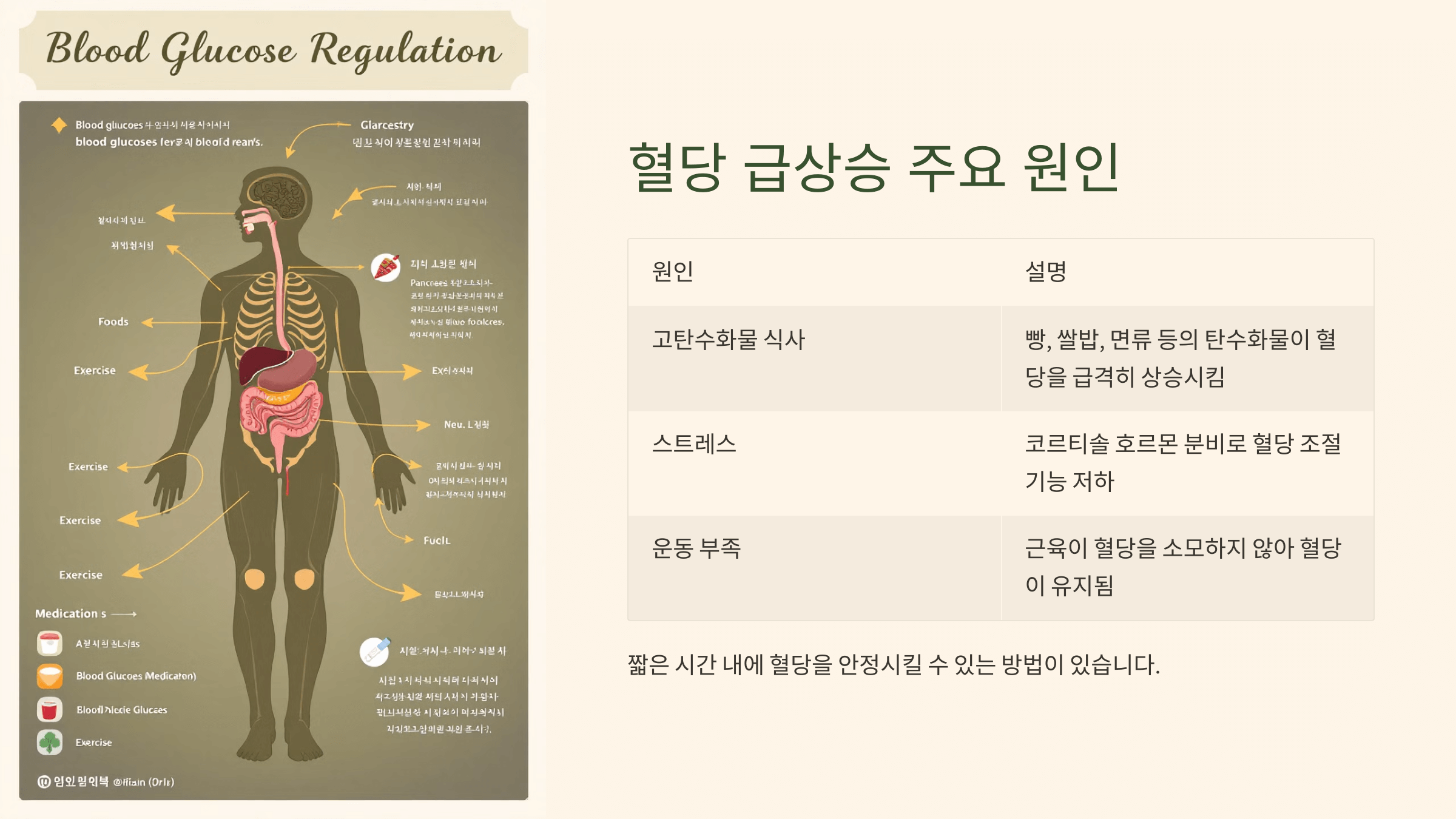 혈당 급상승 주요 원인 이미지