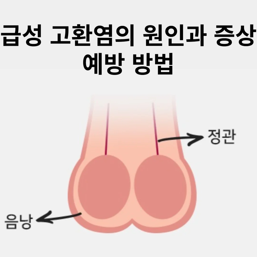 급성고환염
고환 부음
고환 비대