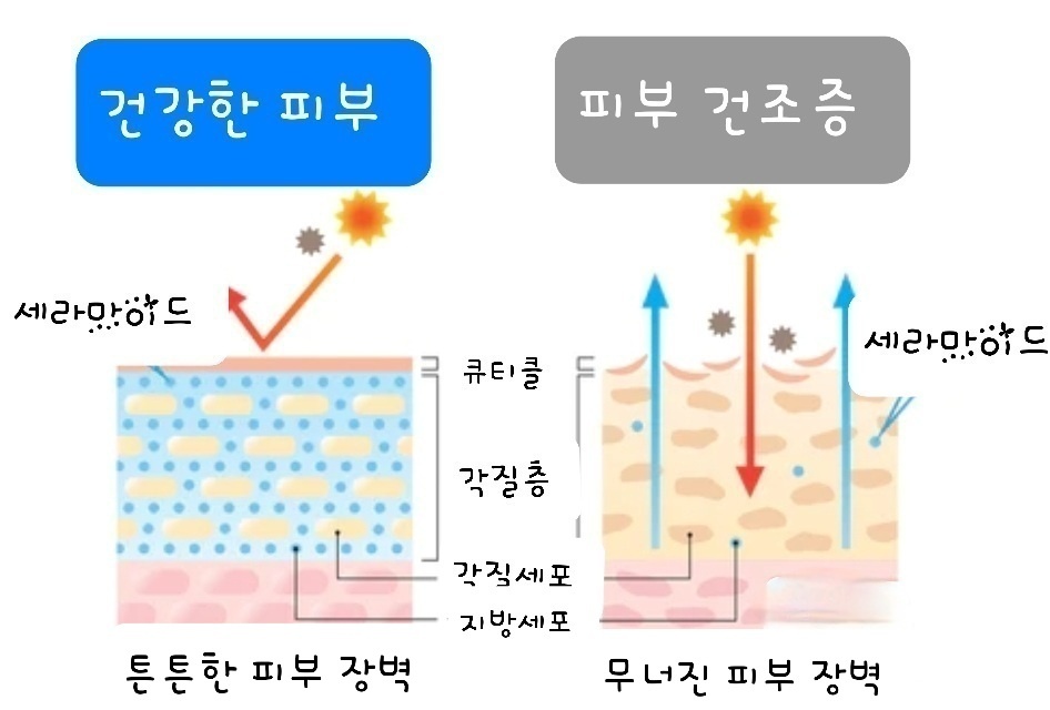 세라마이드 : 튼튼한 피부 장벽과 무너진 피부 장벽