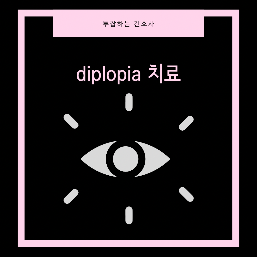 diplopia-치료