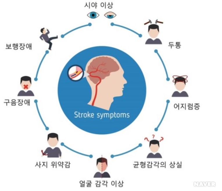 뇌졸중의 증상