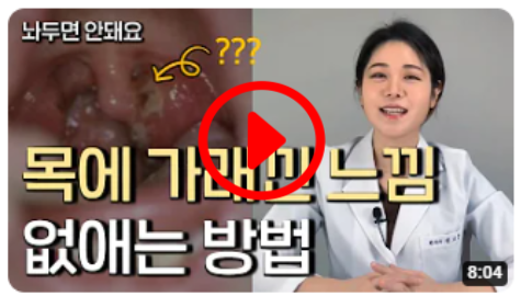 목 이물감&#44; 목에 가래 낀 느낌&#44; 목에 사탕걸린 느낌이 들어요 한달이 넘어도 낫지 않을 때?