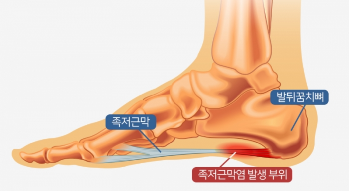 발의 구조 도해