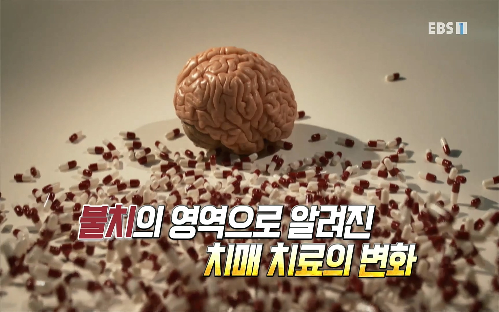 EBS 명의 헬스케어 - TV - 교육의 중심 EBS명의 15년 치매 치료의 패러다임이 바뀐다.mp4_20220808_204654.901.jpg