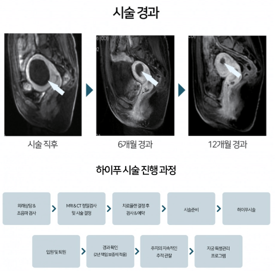 평택 오산 용인 동탄 산부인과 추천