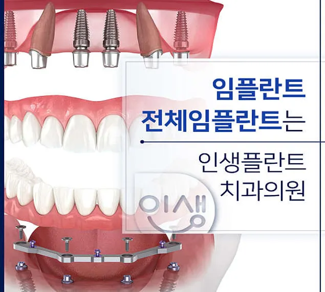 인생플란트치과의원 성남