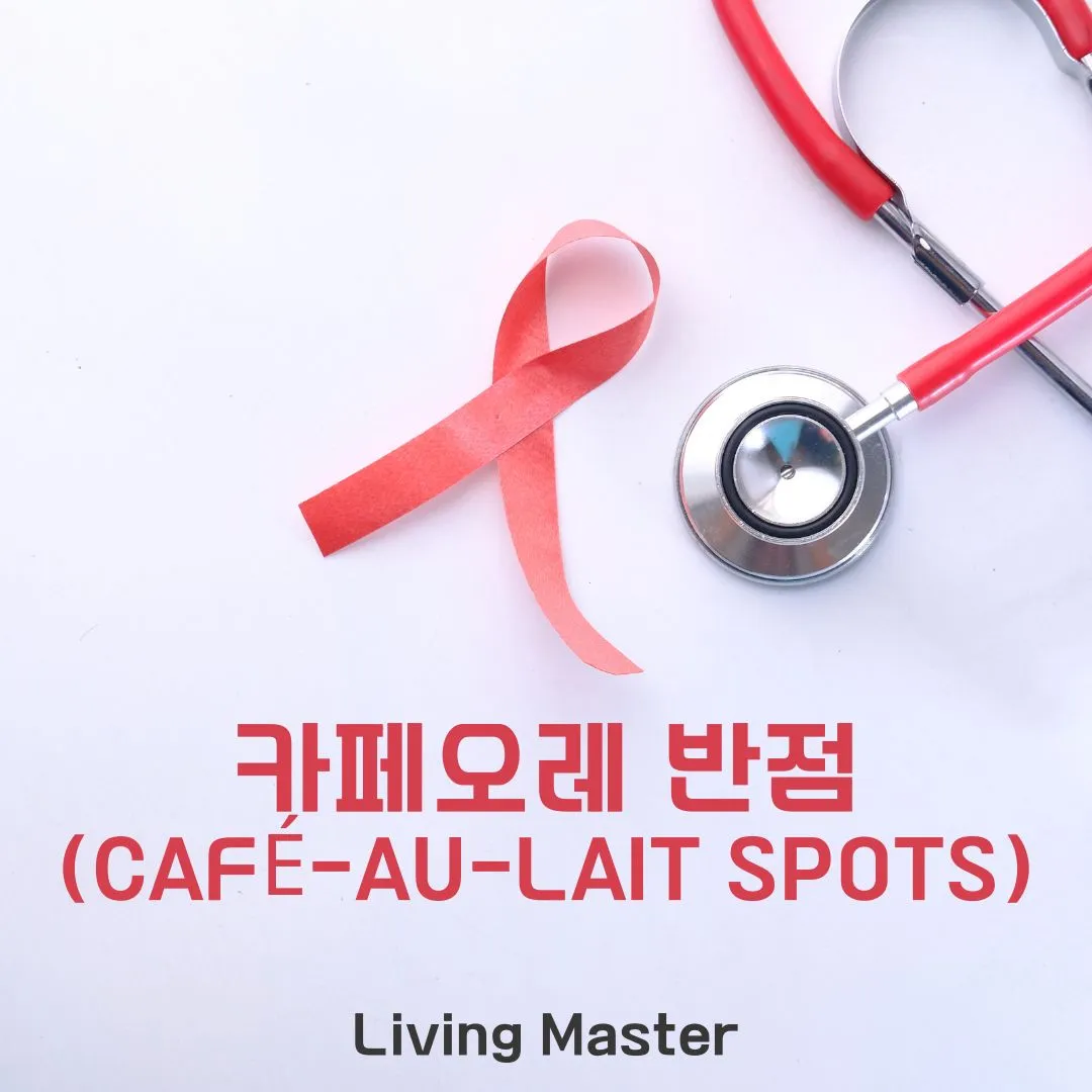 카페오레 반점(Café-au-lait spots)