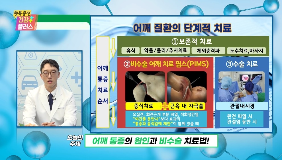  회전근개 손상 치료 어렵지 않습니다