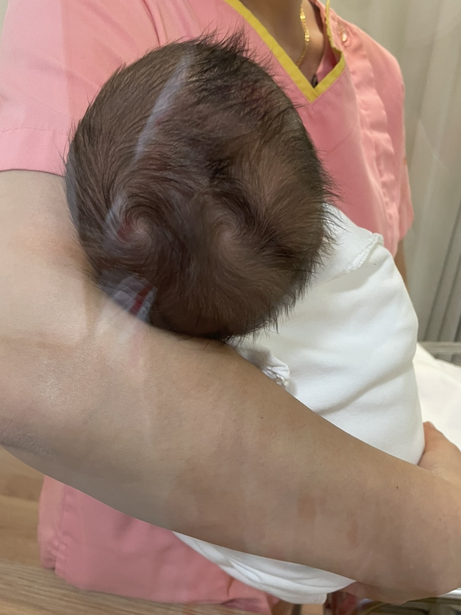 리얼로또 미소래병원 제왕절개리얼후기 및 9